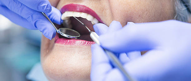 Best Emergency Dental Care for Broken or Chipped Teeth in Brunswick, OH